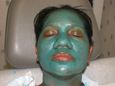 Chemical peel patient